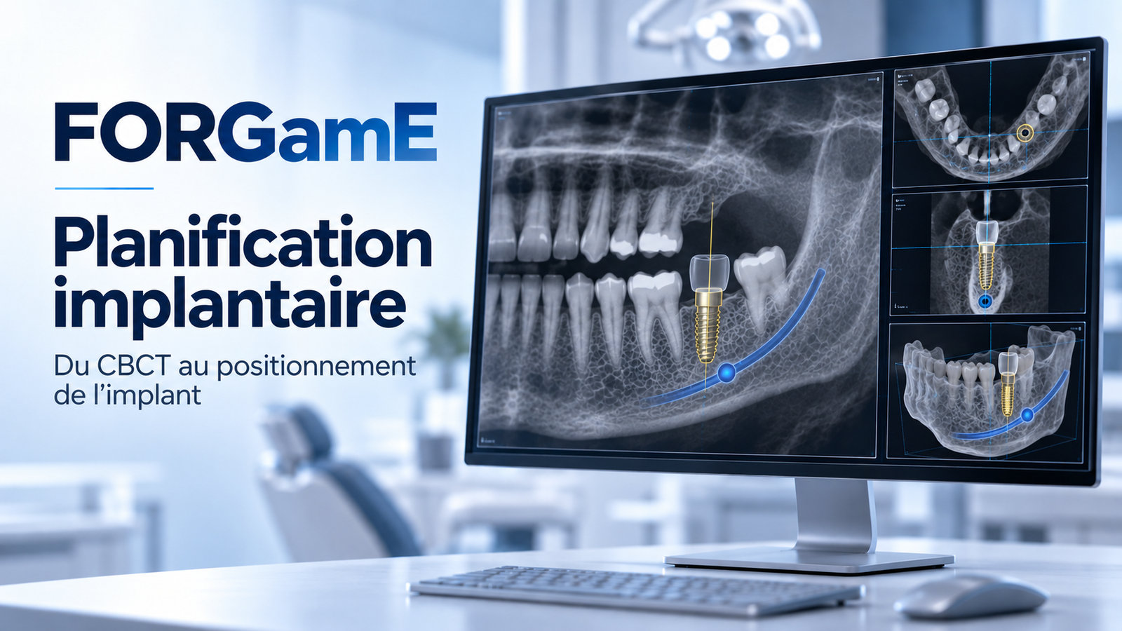 Planification implantaire: CBCT, projet prothétique, planification 3d